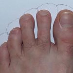 Compatibilité des chaussures FiveFingers selon la morphologie de vos pieds