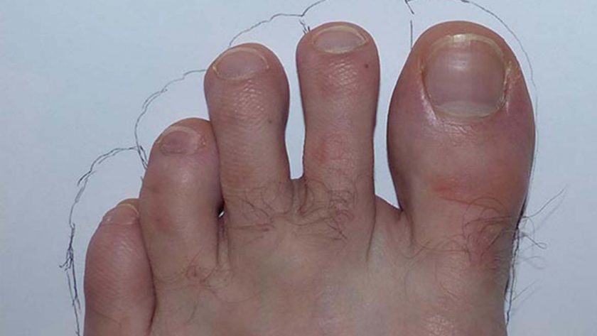 Compatibilité des chaussures FiveFingers selon la morphologie de vos pieds